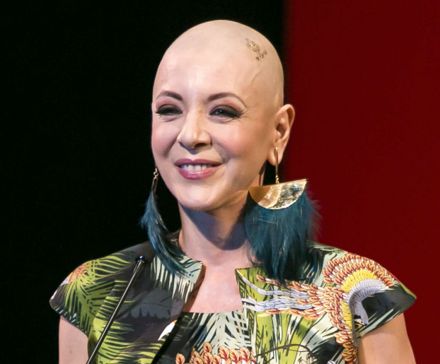 Edith Gonzalez hairfall during battle with Ovarian Cancer. This is the picture while giving an inspirational speech during her fight with life taking disease unfortunately, she lost the battle.